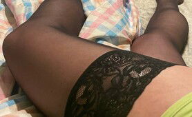 Legs