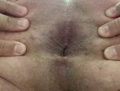 Woefulbypass3