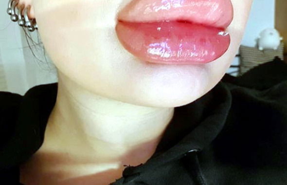 thumb