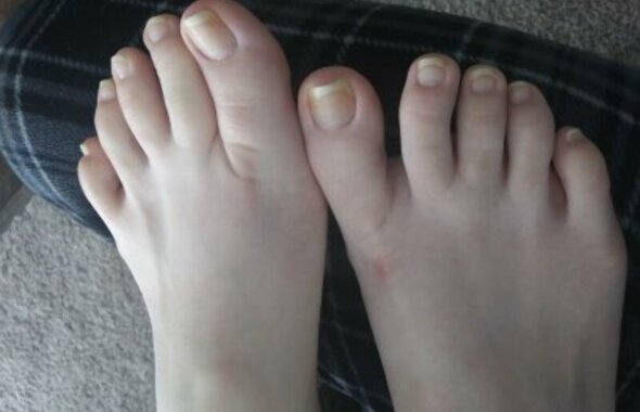 thumb