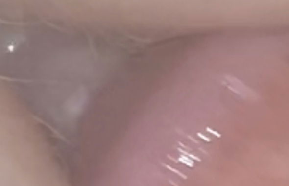 thumb