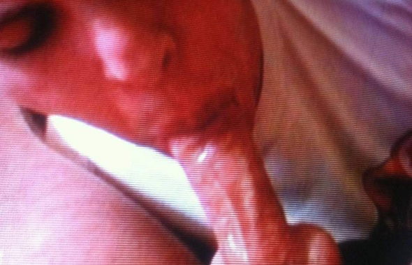 thumb