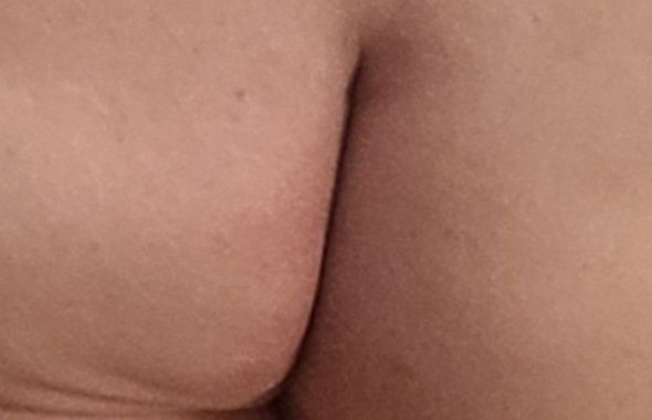 thumb