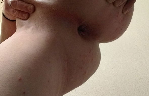 thumb