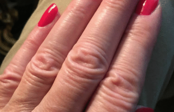 thumb