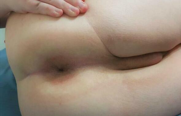 thumb