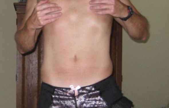 thumb