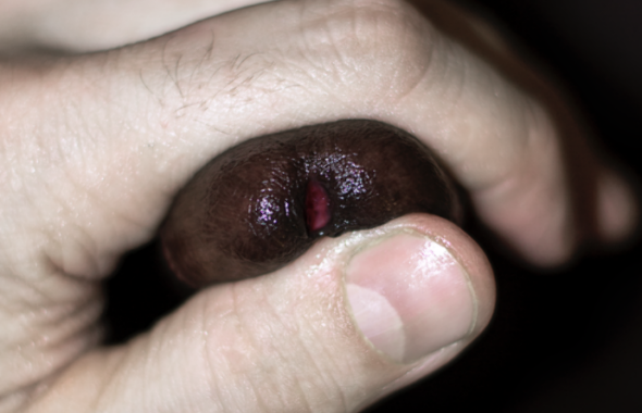 thumb
