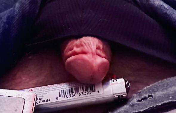 thumb