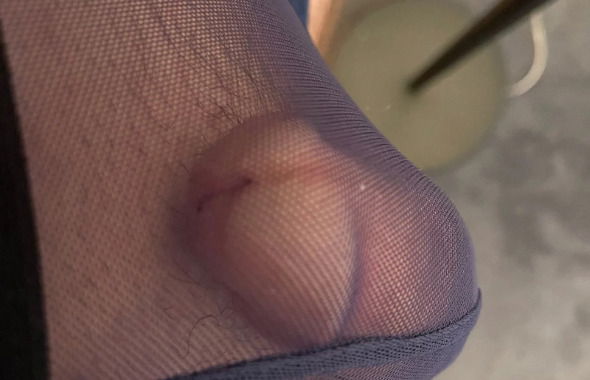 thumb