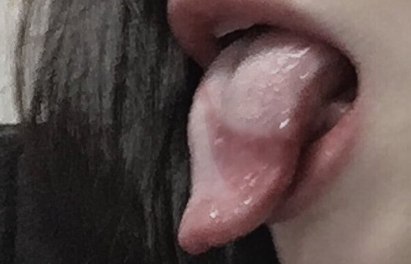 thumb