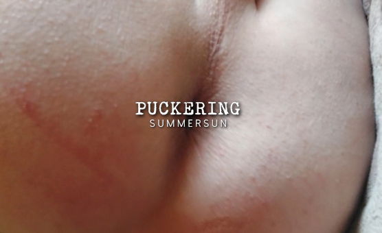 Puckering